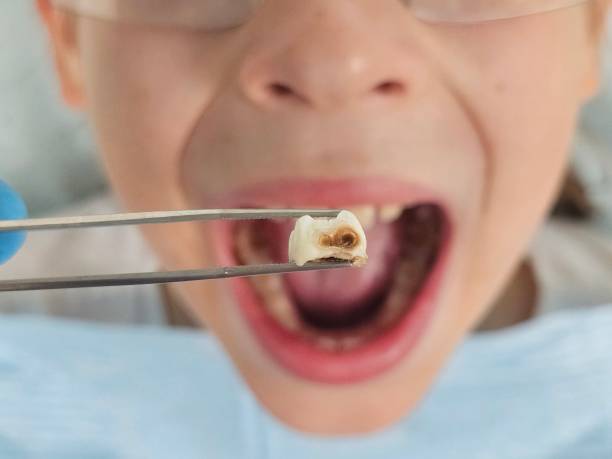 Best Emergency Treatment for Jaw Pain or Injury in Macarthur, WV